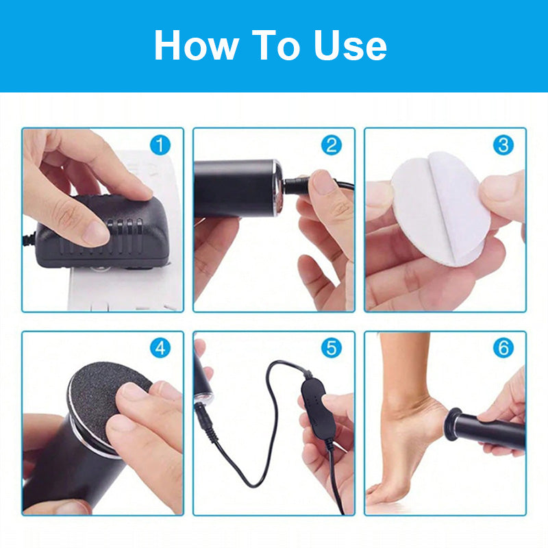 Electric Callus Remover