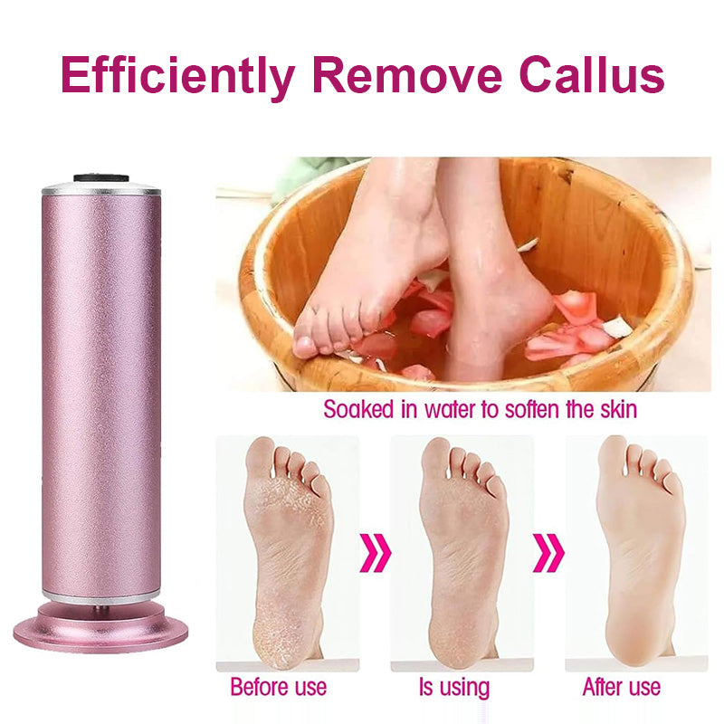 Electric Callus Remover