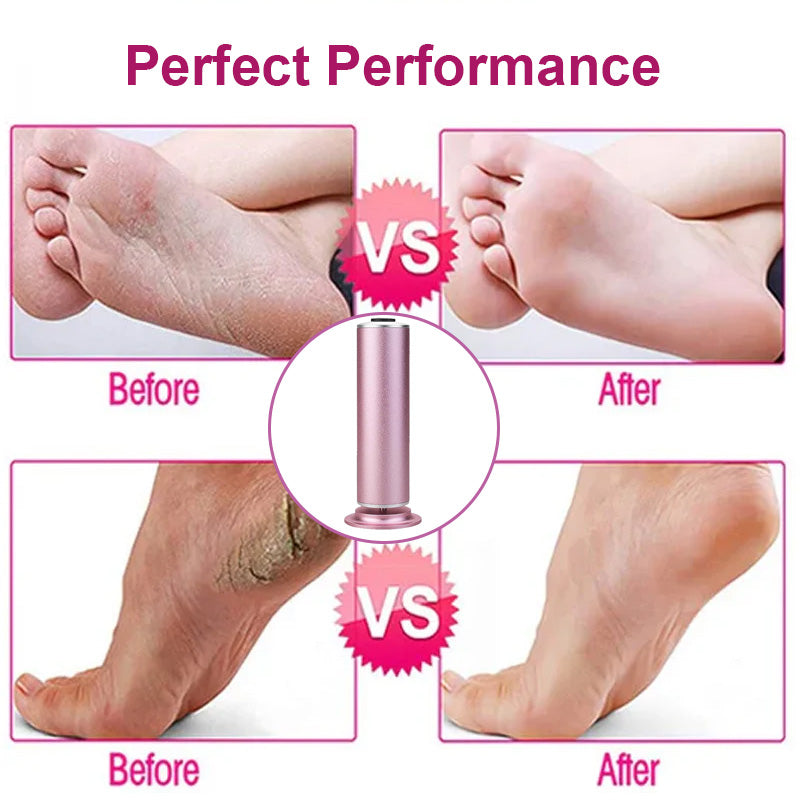Electric Callus Remover