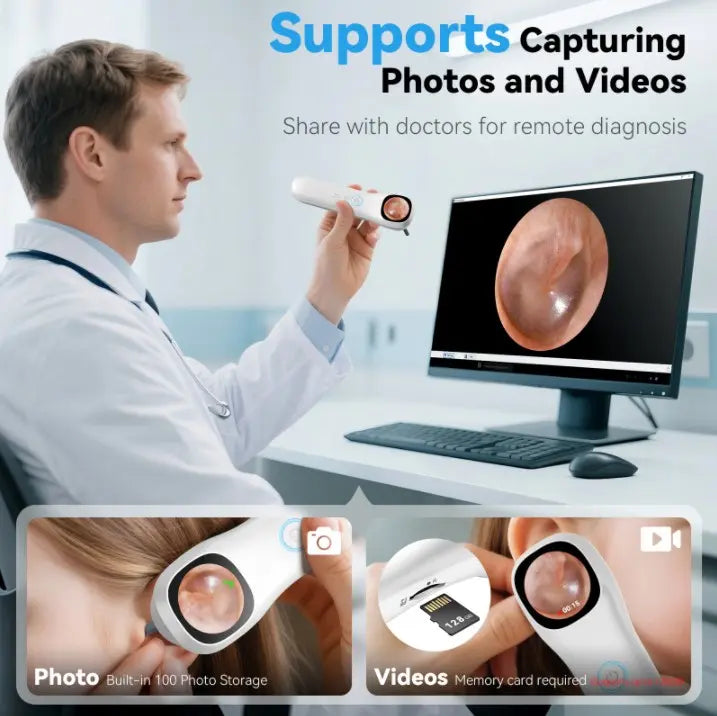 1080P HD Digital Otoscope With Screen