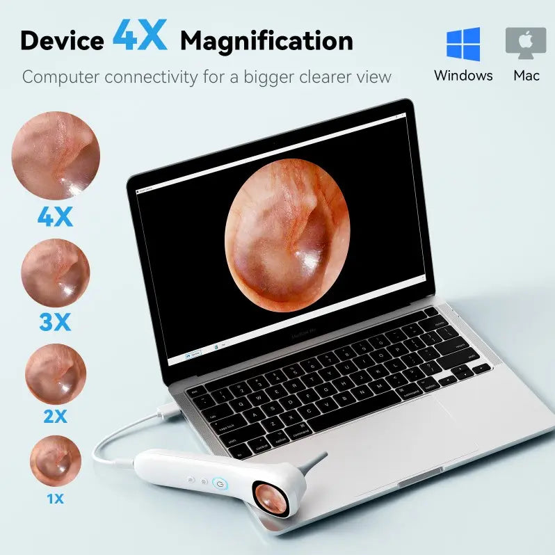 1080P HD Digital Otoscope With Screen