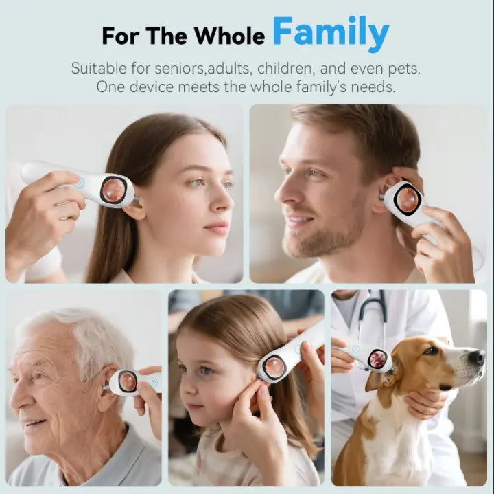 1080P HD Digital Otoscope With Screen